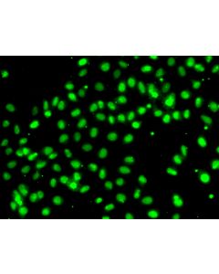 MEPCE Polyclonal Antibody (E-AB-61539) elabscience