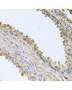 MEMO1 Polyclonal Antibody (E-AB-63109) elabscience