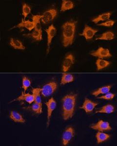 SLC20A1 Polyclonal Antibody (E-AB-63776) elabscience