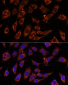 GFPT2 Polyclonal Antibody (E-AB-65288) elabscience