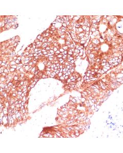 FAM98A Polyclonal Antibody (E-AB-66587) elabscience