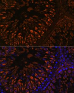 FER1L5 Polyclonal Antibody (E-AB-66628) elabscience