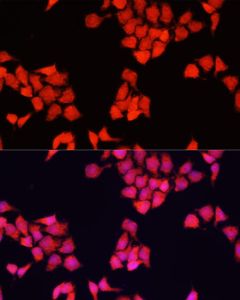 FXR1 Polyclonal Antibody (E-AB-66823) elabscience