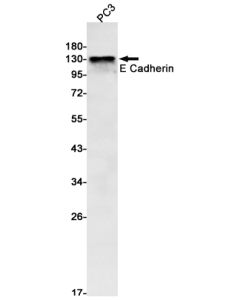 Recombinant E Cadherin Monoclonal Antibody (E-AB-81424) elabscience