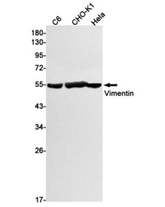 Recombinant Vimentin Monoclonal Antibody (E-AB-81438) elabscience