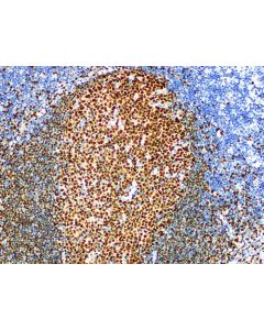 BOB.1 Monoclonal Antibody (ELAB6111-M) elabscience