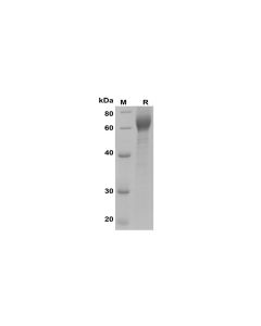 Recombinant Human ILT6/LILRA3 Protein (His Tag) (PDMH100137) elabscience