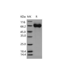 Recombinant Human CHST15/BRAG Protein (His Tag) (PKSH031295) elabscience