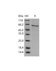 Recombinant Human AKT1/PKB/PKBα Protein (His Tag) (PKSH031439) elabscience