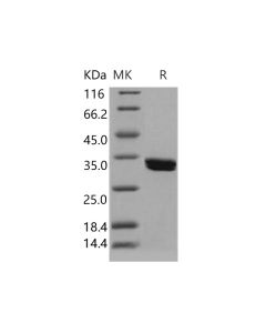Recombinant Human CDK2 Protein (Baculovirus, His Tag) (PKSH031501) elabscience