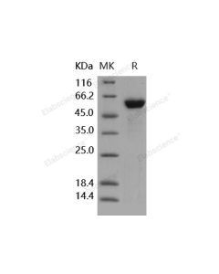 Recombinant Human HMGB1/HMG1 Protein (Fc Tag) (PKSH031686) elabscience