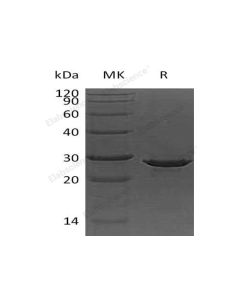 Recombinant Human Apolipoprotein A-I/ApoAI Protein (His Tag, E. coli) (PKSH032081) elabscience