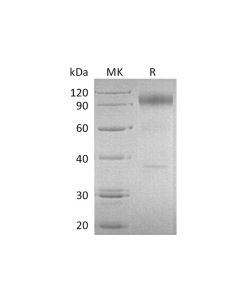 Recombinant Human IL-23 Recetor/IL-23R Protein (Fc Tag) (PKSH032579) elabscience