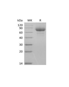 Recombinant Human Leukocyte Ig-Like Receptor A3/LILRA3/ILT6/CD85e (C-6His-Avi) Biotinylated (PKSH033986) elabscience
