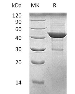 Recombinant Human Beta-Actin (C-6His)(Cat. No.:CE15) novoprotein