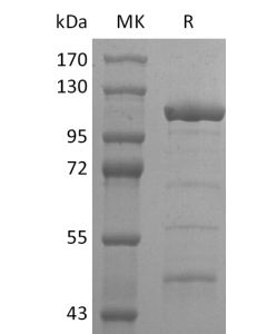 Recombinant 2019-nCoV Helicase (N-6His-MBP)(Cat. No.:CR84) novoprotein