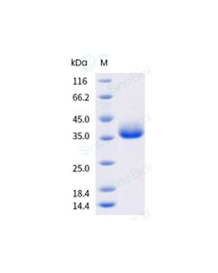 Recombinant Human ILT3/LILRB4 Protein (ECD, His Tag), HPLC-verified sinobiological 16742-H08H