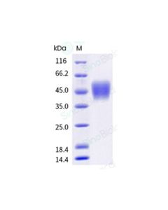 Recombinant Human CD16a/FCGR3A/Fc gamma RIIIA Protein (F176, His Tag), HPLC-verified sinobiological 10389-H08H