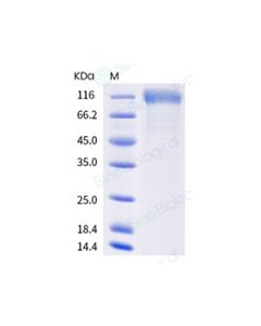 SARS-CoV-2 (2019-nCoV) Spike S1(K417N, E484K, N501Y, D614G)-His Recombinant Protein sinobiological 40591-V08H10