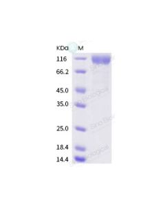 SARS-CoV-2 (2019-nCoV) Spike S1(D614G)-His Recombinant Protein, (HPLC-verified) sinobiological 40591-V08H3