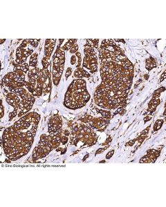 Beta-Tubulin Loading Control Antibody, Mouse MAb sinobiological 100109-MM05T
