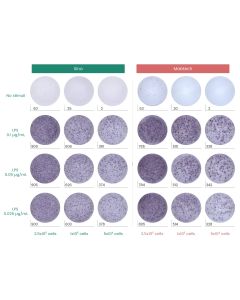 Mouse TNF-α ELISpot Kit (ALP) sinobiological EK50349A