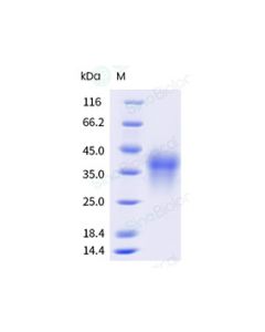 Recombinant Rhesus PD-1 Protein (His Tag), HPLC-verified sinobiological 90305-K08H