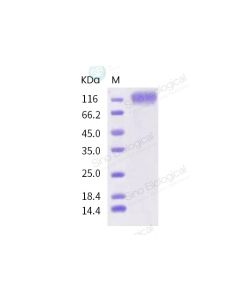 SARS-CoV-2 (2019-nCoV) Spike S1-His Recombinant Protein (HPLC-verified) sinobiological 40591-V08H