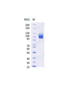 Recombinant Human EGFR Protein (ECD, His Tag), HPLC-verified sinobiological 10001-H08H