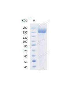 SARS-CoV-2 B.1.617.2 Spike S1+S2 trimer Protein (ECD, His tag) (HPLC-verified) sinobiological 40589-V08H10