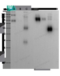 SARS-CoV-2 (2019-nCoV) Spike RBD Antibody, Rabbit PAb, Antigen Affinity Purified sinobiological 40592-T62