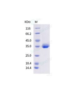 SARS-CoV-2 (2019-nCoV) Spike RBD(K417N, E484K, N501Y)-His Recombinant Protein sinobiological 40592-V08H85