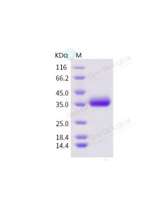 SARS-CoV-2 (2019-nCoV) Spike RBD-His Recombinant Protein sinobiological 40592-V08H
