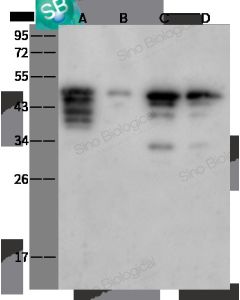 SARS-CoV-2 (2019-nCoV) Nucleocapsid Antibody, Rabbit PAb, Antigen Affinity Purified sinobiological 40588-T62