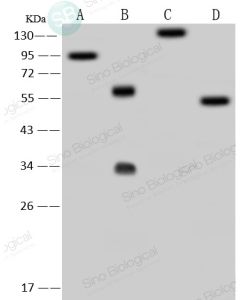 SARS-CoV-2 (2019-nCoV) Spike Antibody, Rabbit PAb, Antigen Affinity Purified sinobiological 40591-T62