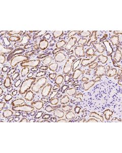 Anti-MTHFD2 Antibody, Rabbit Polyclonal sinobiological 203834-T08