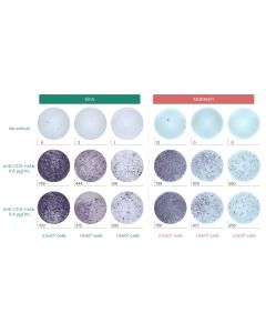 Human IFN-γ ELISpot Kit (ALP) sinobiological EK11725A