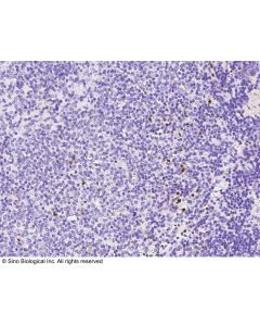 Anti-MMP-9 Antibody, Rabbit Polyclonal sinobiological 80049-T24