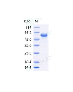 Recombinant Human CD40/TNFRSF5 Protein (ECD, hFc Tag), HPLC-verified sinobiological 10774-H02H