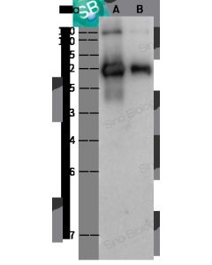 SARS-CoV-2 (2019-nCoV) Spike S2 Antibody, Rabbit PAb, Antigen Affinity Purified sinobiological 40590-T62
