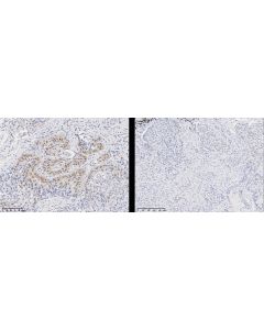 Recombinant Phospho-AKT (Ser473) Antibody, Rabbit Monoclonal sinobiological 110591-R0113