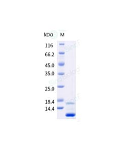 Recombinant Human IL-13 Protein, HPLC-verified sinobiological 10369-HNAC