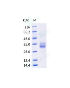Recombinant Human 4-1BB/CD137 Protein (ECD, His Tag), HPLC-verified sinobiological 10041-H08H