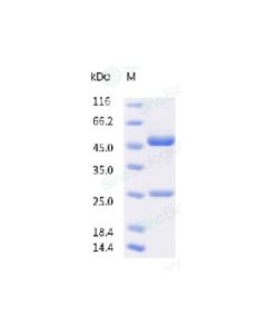 Anti-SARS-COV-2 Spike (Research Grade Sotrovimab Biosimilar) sinobiological 68146-H001