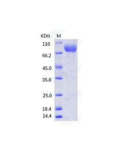 Recombinant Human CD155/PVR Protein (ECD, hFc Tag), HPLC-verified sinobiological 10109-H02H
