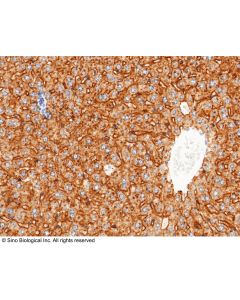Recombinant Anti-ASGR1 Antibody, Rabbit Monoclonal sinobiological 50083-R114