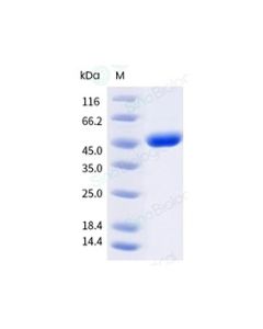 Recombinant Human LAG-3 Protein (ECD), Amine-Labeled Biotinylated, HPLC-verified sinobiological 16498-HNAH-B