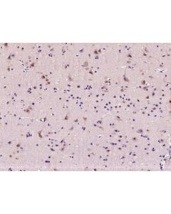 Anti-MAP1/MOAP1 Antibody, Rabbit Polyclonal sinobiological 100970-T08