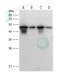 SARS-CoV / SARS-CoV-2 Nucleocapsid Antibody, Rabbit PAb, Antigen Affinity Purified sinobiological 40143-T62