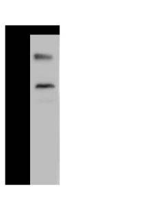Anti-LRRC8D Antibody, Rabbit Polyclonal sinobiological 104245-T32